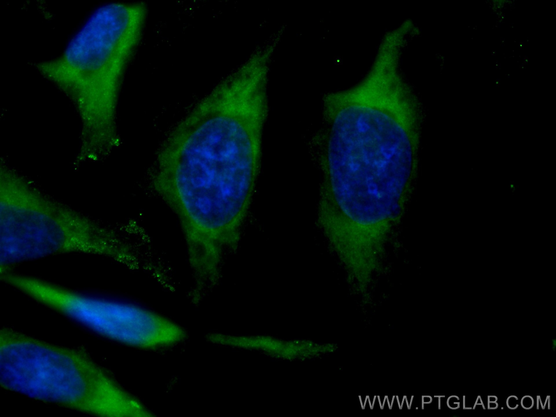 IF Staining of HeLa using CL488-10894