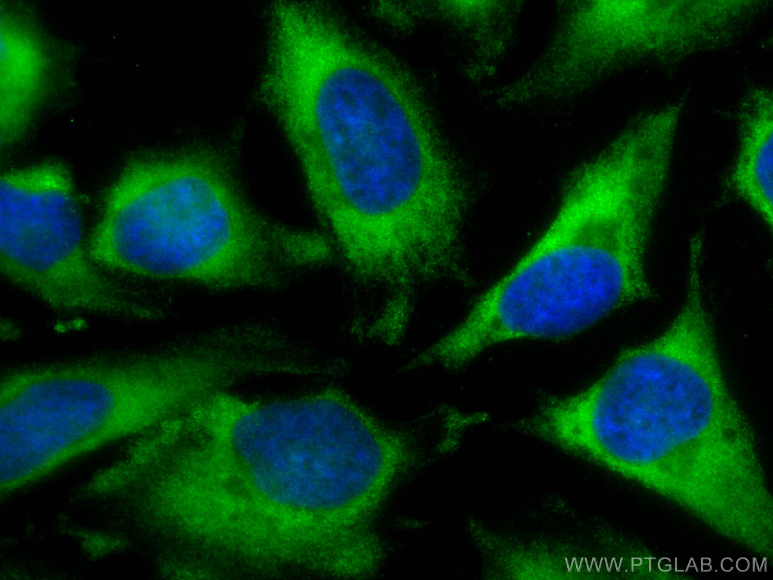 Immunofluorescence (IF) / fluorescent staining of HeLa cells using CoraLite® Plus 488-conjugated CYB5R3 Monoclonal an (CL488-66022)