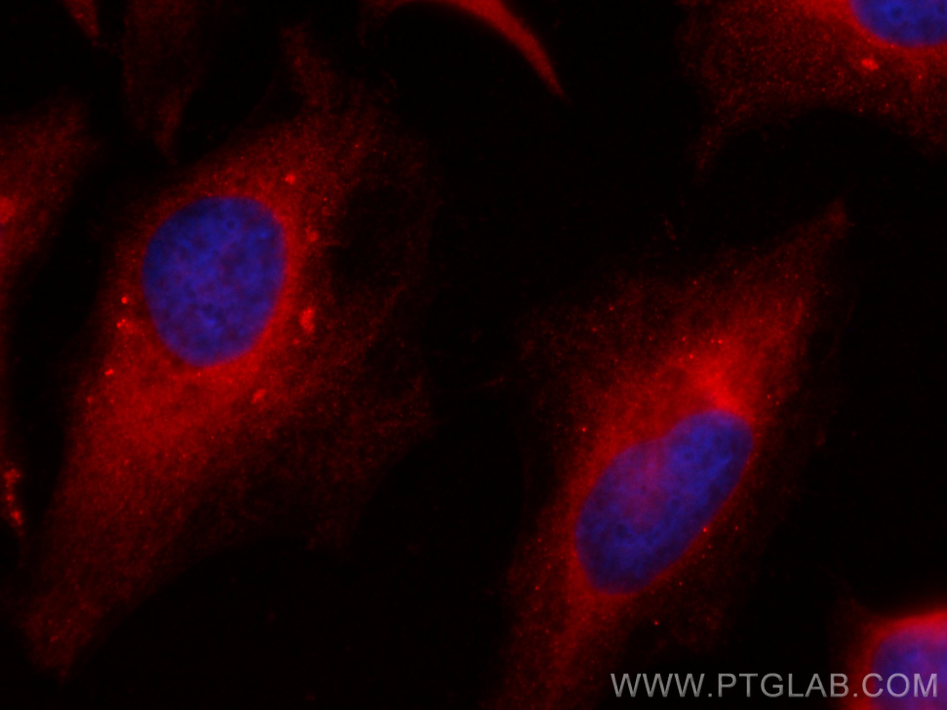 IF Staining of HeLa using CL594-10894