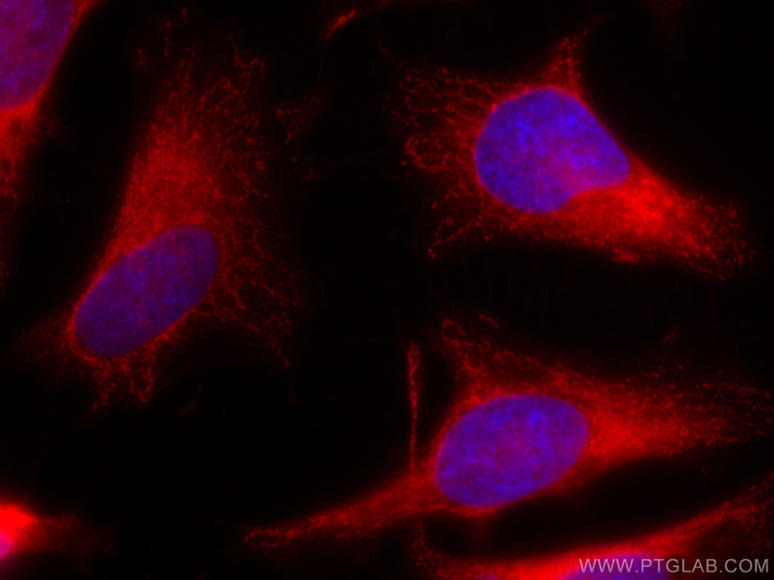 IF Staining of HeLa using CL594-66022