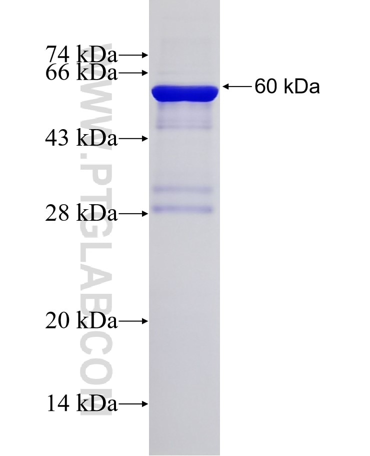 CYB5R3 fusion protein Ag1339 SDS-PAGE