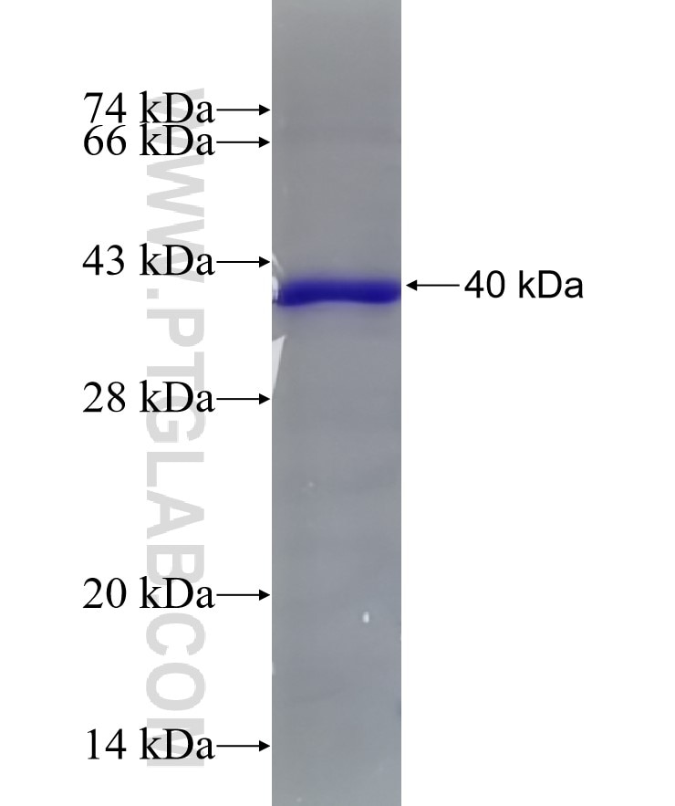 CYB5R3 fusion protein Ag18096 SDS-PAGE