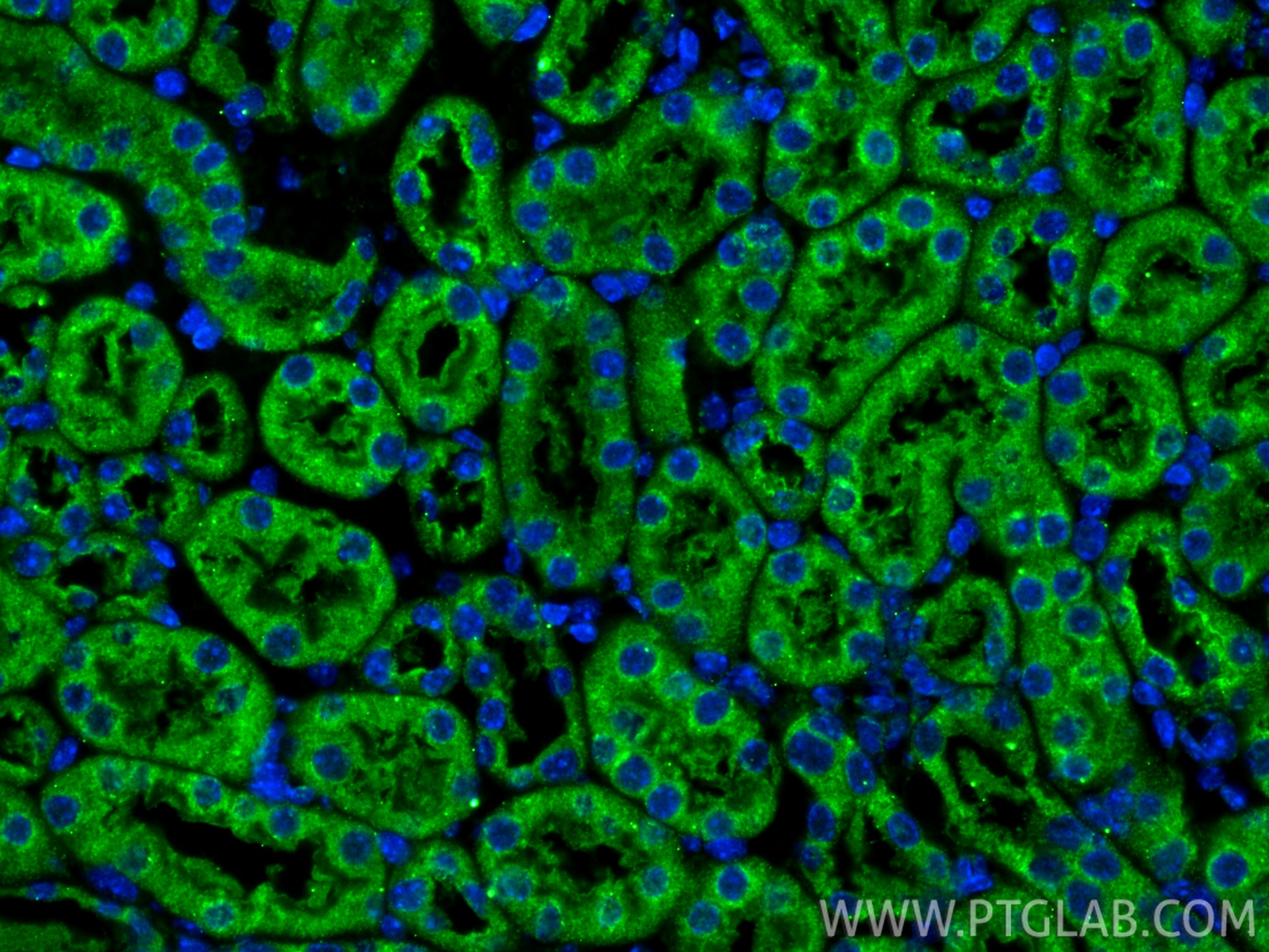 Immunofluorescence (IF) / fluorescent staining of mouse kidney tissue using CYB5R4 Polyclonal antibody (12626-1-AP)