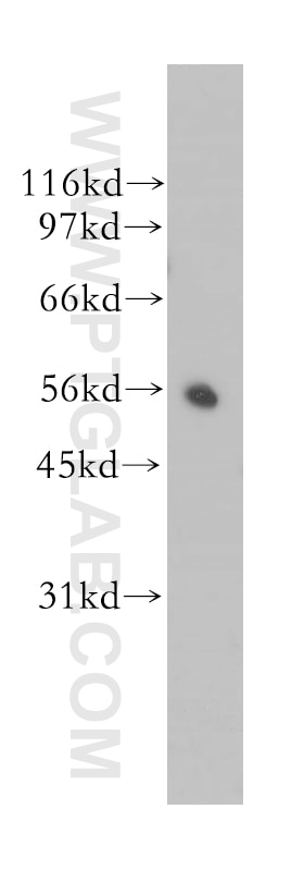 Western Blot (WB) analysis of HeLa cells using CYB5R4 Polyclonal antibody (12626-1-AP)