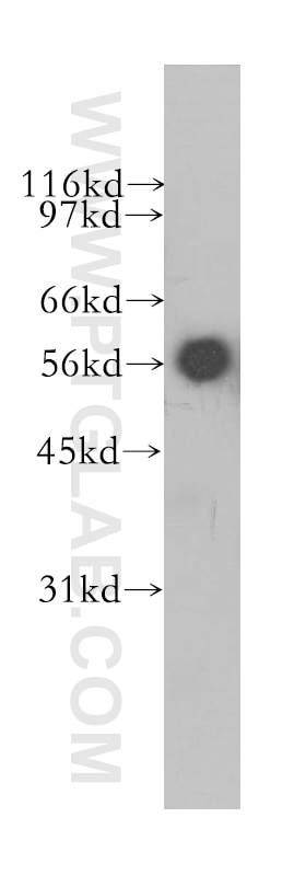Western Blot (WB) analysis of BxPC-3 cells using CYB5R4 Polyclonal antibody (12626-1-AP)