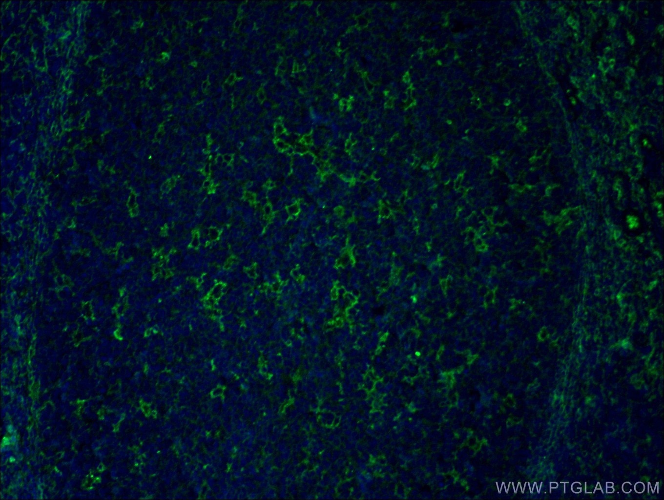 Immunofluorescence (IF) / fluorescent staining of human tonsillitis tissue using NOX2 Polyclonal antibody (19013-1-AP)