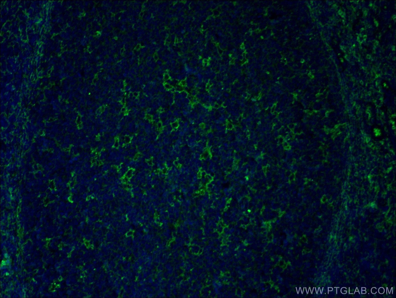 IF Staining of human tonsillitis using 19013-1-AP