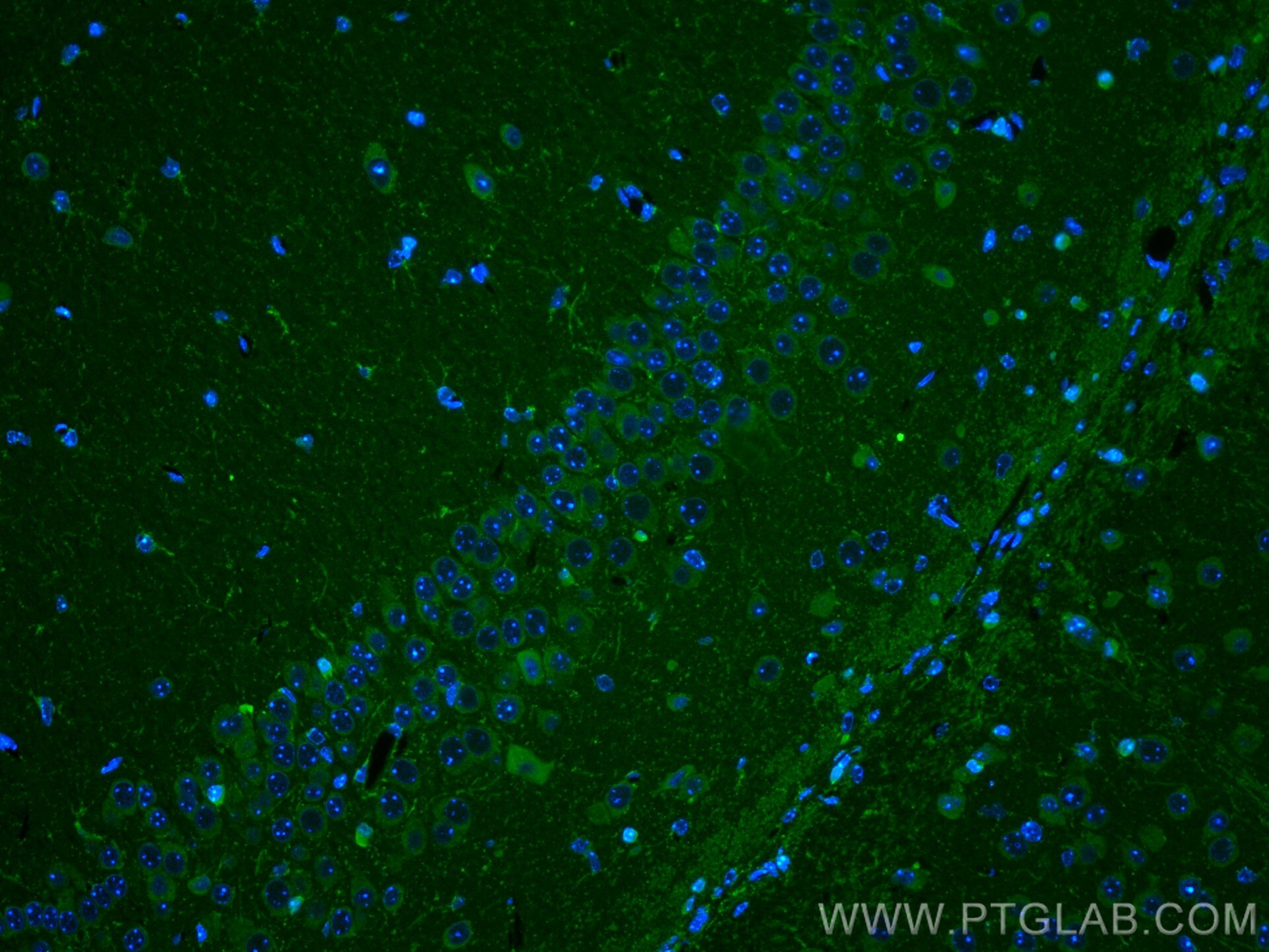 Immunofluorescence (IF) / fluorescent staining of mouse brain tissue using NOX2 Polyclonal antibody (19013-1-AP)