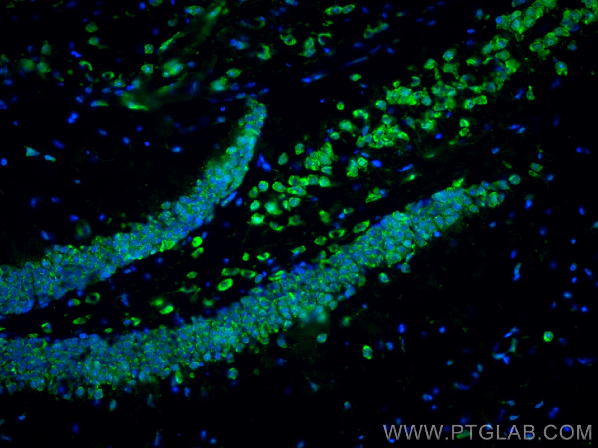 Immunofluorescence (IF) / fluorescent staining of mouse brain tissue using NOX2 Polyclonal antibody (19013-1-AP)