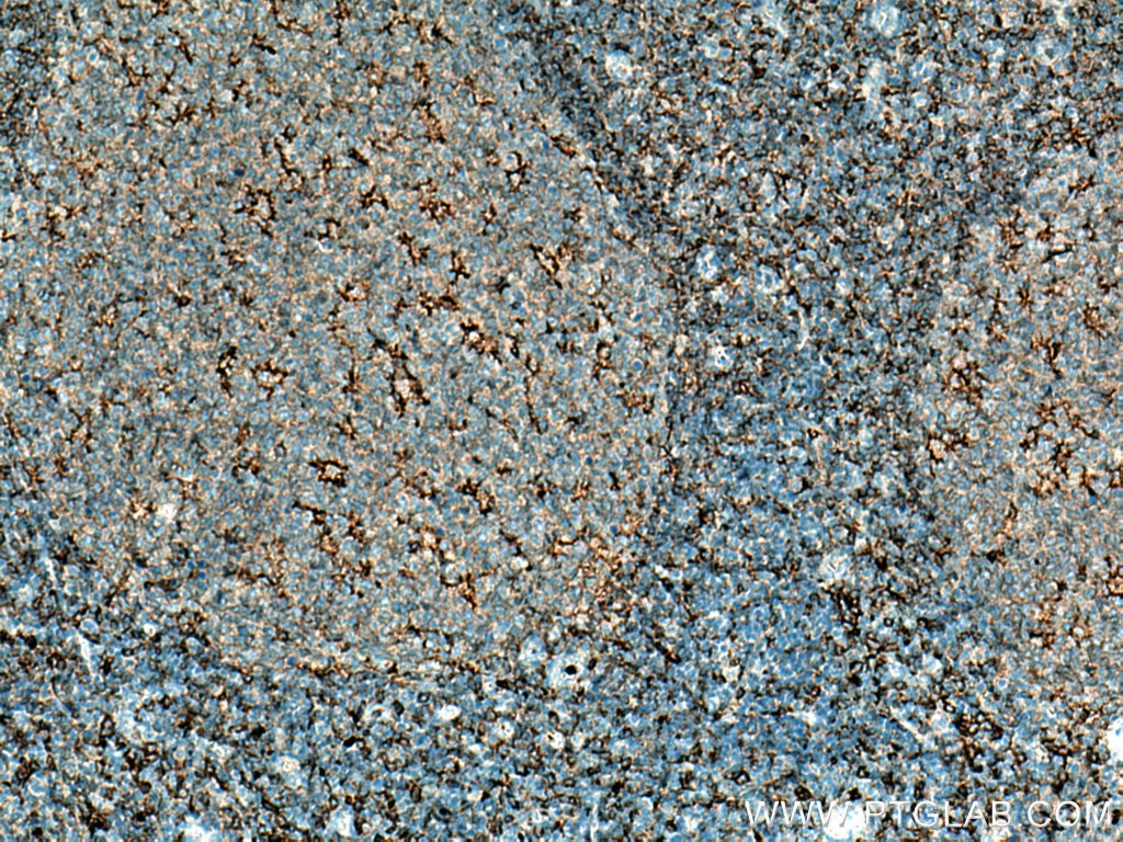 Immunohistochemistry (IHC) staining of human tonsillitis tissue using NOX2 Polyclonal antibody (19013-1-AP)