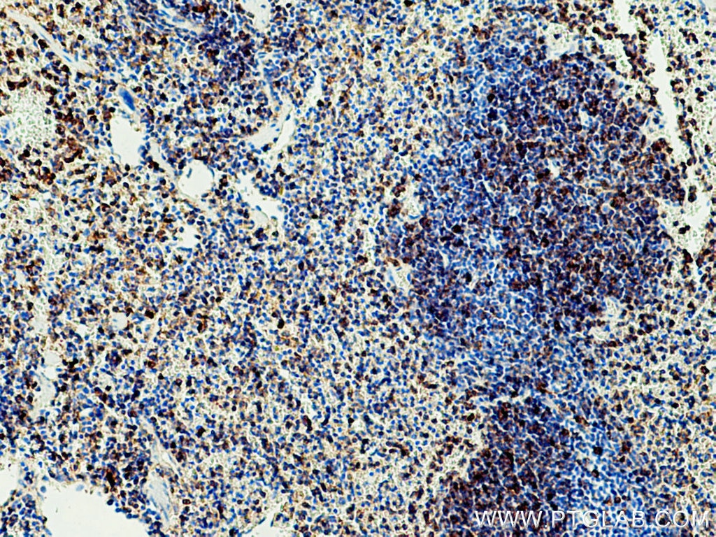 Immunohistochemistry (IHC) staining of mouse spleen tissue using NOX2 Polyclonal antibody (19013-1-AP)