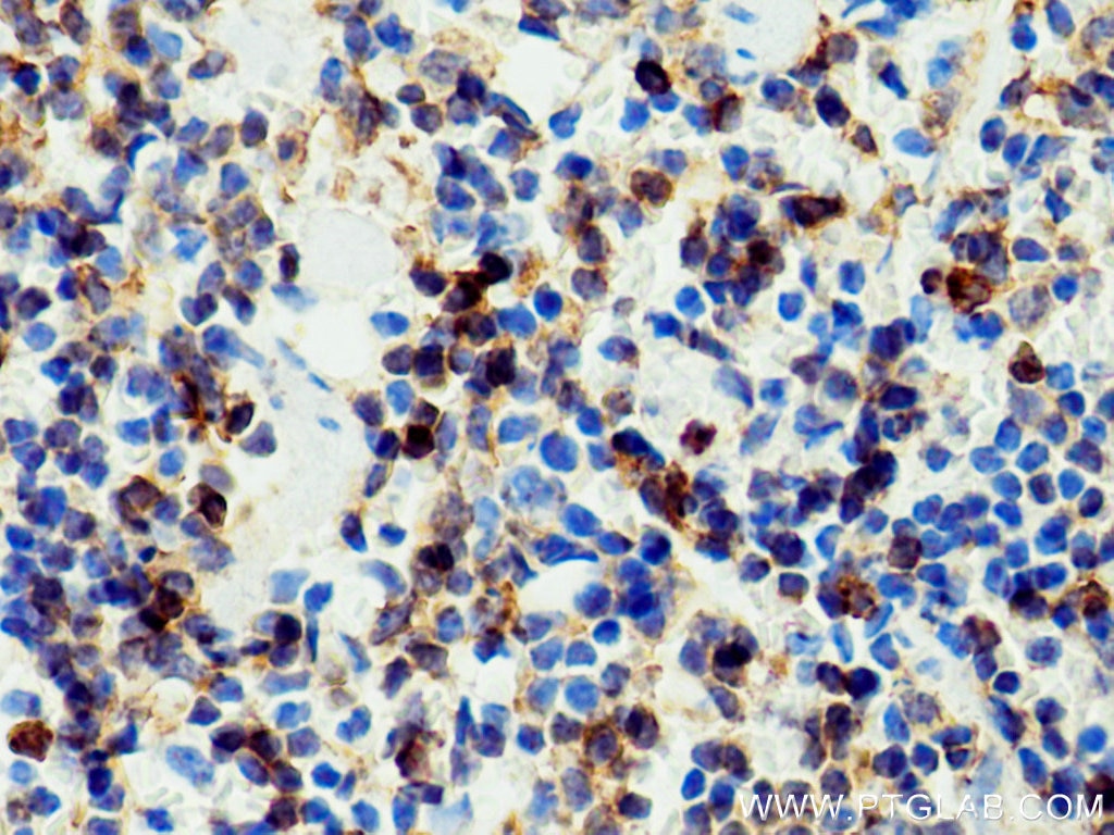 Immunohistochemistry (IHC) staining of mouse spleen tissue using NOX2 Polyclonal antibody (19013-1-AP)