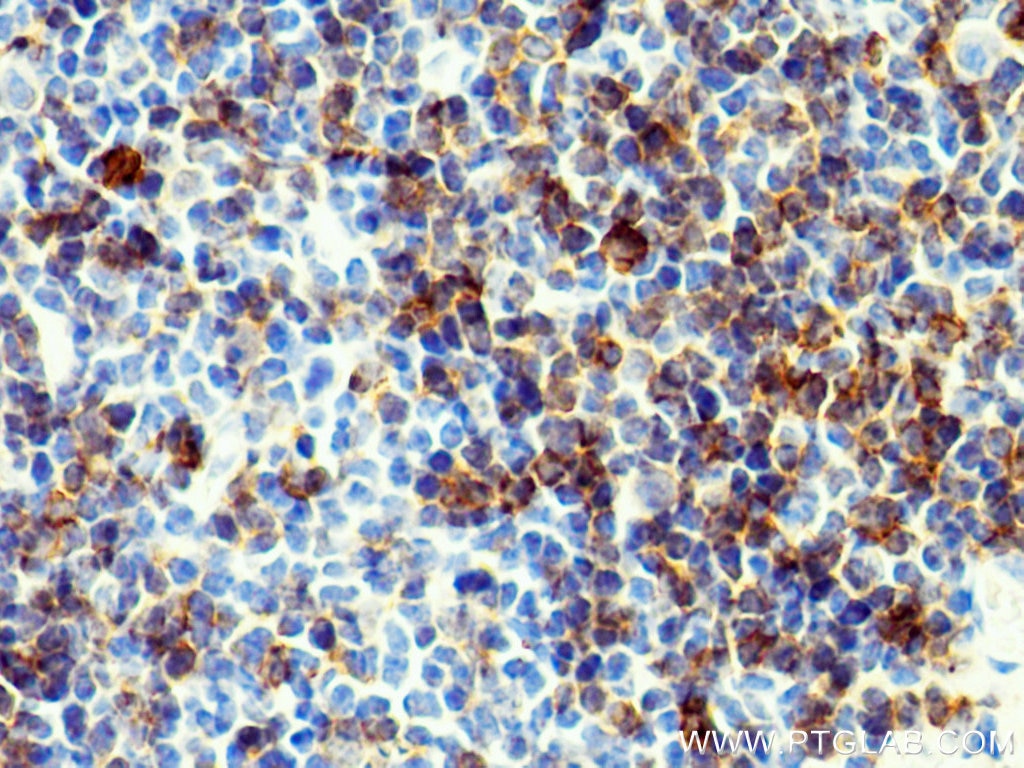 Immunohistochemistry (IHC) staining of mouse spleen tissue using NOX2 Polyclonal antibody (19013-1-AP)