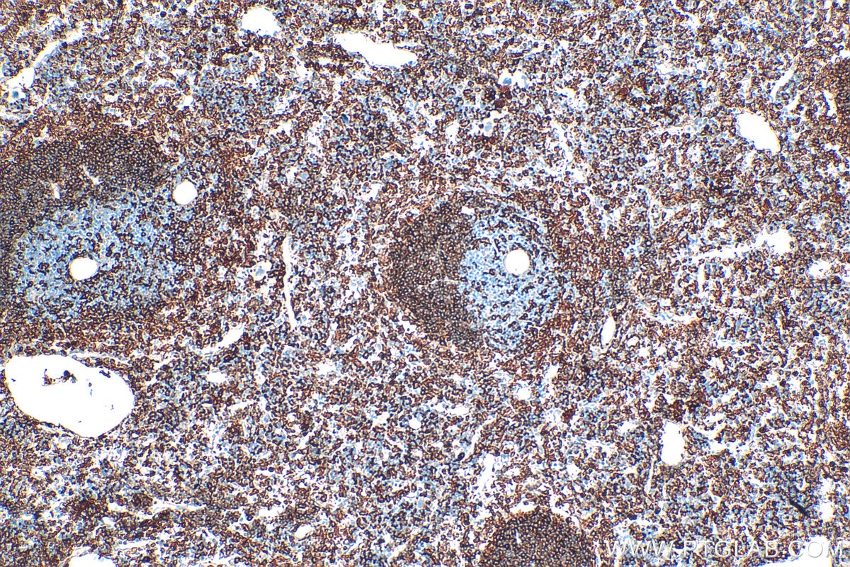 Immunohistochemistry (IHC) staining of mouse spleen tissue using NOX2 Polyclonal antibody (19013-1-AP)