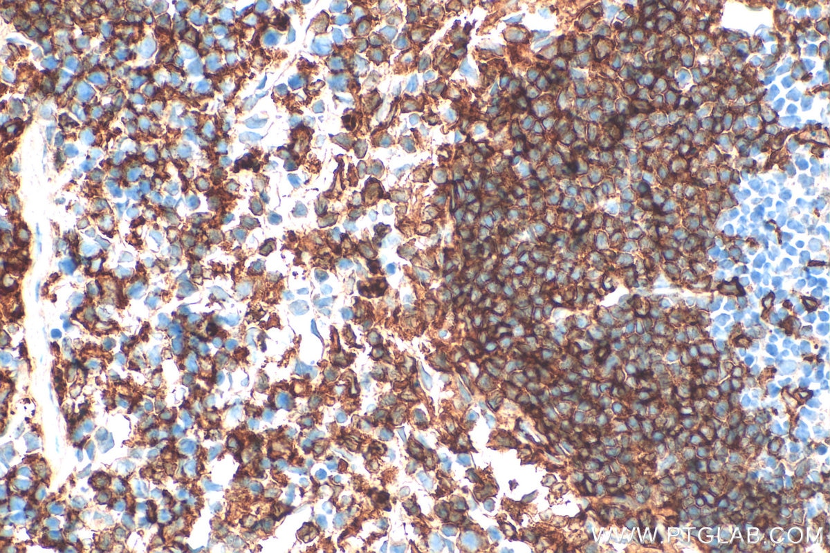 Immunohistochemistry (IHC) staining of mouse spleen tissue using NOX2 Polyclonal antibody (19013-1-AP)