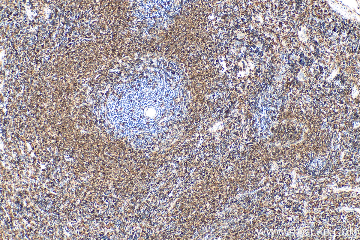 Immunohistochemical analysis of paraffin-embedded rat spleen tissue slide using 19013-1-AP (NOX2 antibody) at dilution of 1:1000 (under 10x lens). Heat mediated antigen retrieval with Tris-EDTA buffer (pH 9.0). Immunohistochemistry (IHC) staining of rat spleen tissue using NOX2 Polyclonal antibody (19013-1-AP)