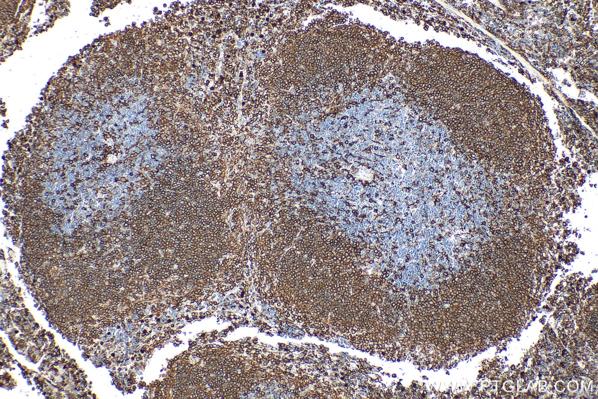 Immunohistochemistry (IHC) staining of mouse spleen tissue using NOX2 Polyclonal antibody (19013-1-AP)