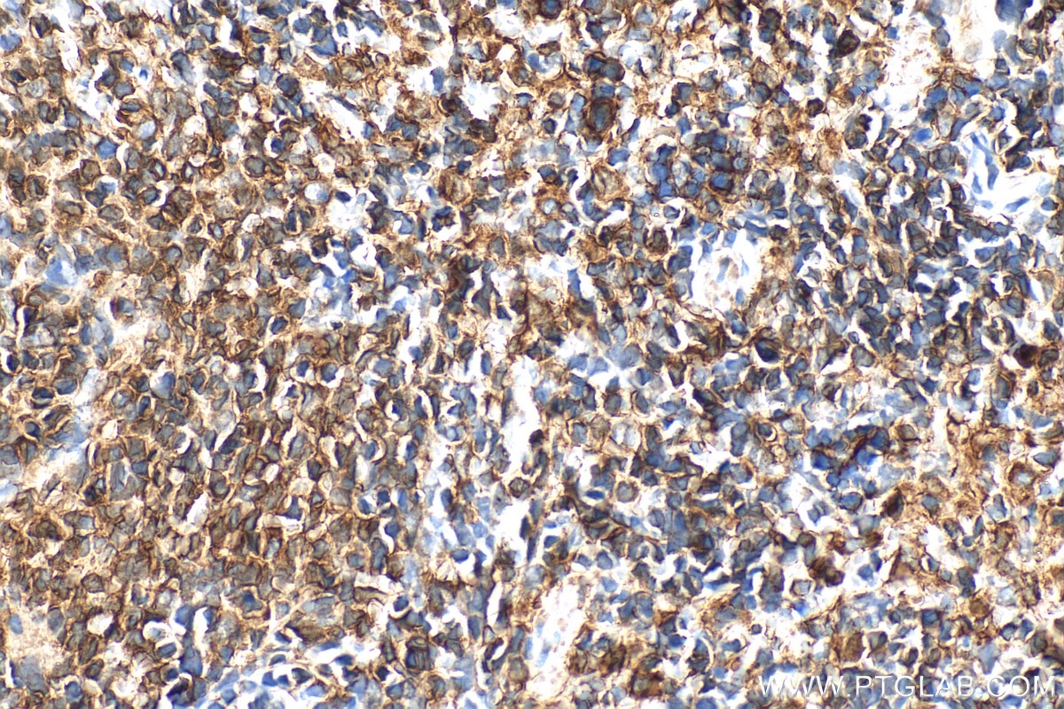 Immunohistochemical analysis of paraffin-embedded rat spleen tissue slide using 19013-1-AP (NOX2 antibody) at dilution of 1:1000 (under 40x lens). Heat mediated antigen retrieval with Tris-EDTA buffer (pH 9.0). Immunohistochemistry (IHC) staining of rat spleen tissue using NOX2 Polyclonal antibody (19013-1-AP)