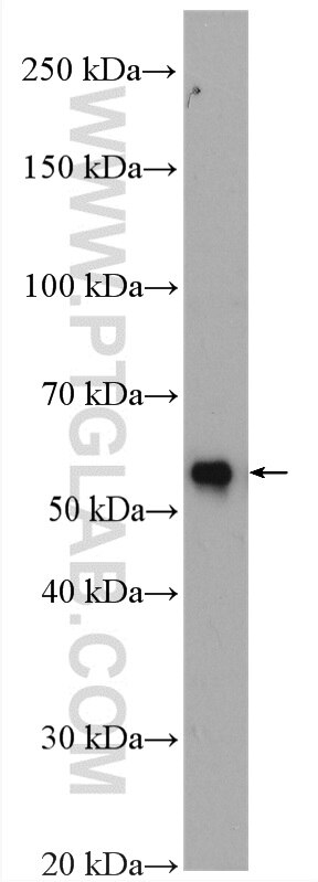 Western Blot (WB) analysis of mouse spleen tissue using NOX2 Polyclonal antibody (19013-1-AP)