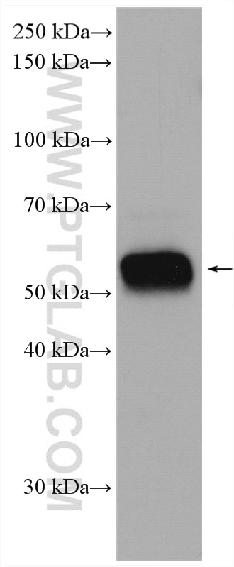 Western Blot (WB) analysis of mouse spleen tissue using NOX2 Polyclonal antibody (19013-1-AP)