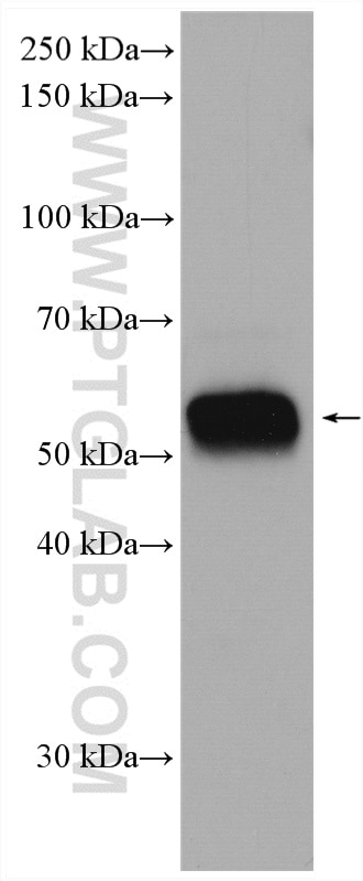 WB analysis of mouse spleen using 19013-1-AP