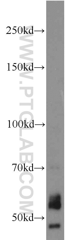 Western Blot (WB) analysis of Raji cells using NOX2 Polyclonal antibody (19013-1-AP)