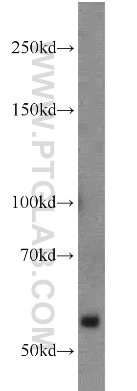 Western Blot (WB) analysis of human plasma using NOX2 Polyclonal antibody (19013-1-AP)