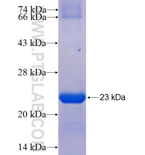 CYBB fusion protein Ag5536 SDS-PAGE