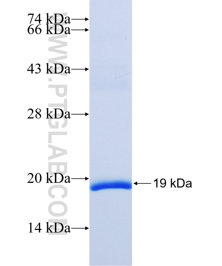 CYBB fusion protein Ag5536 SDS-PAGE