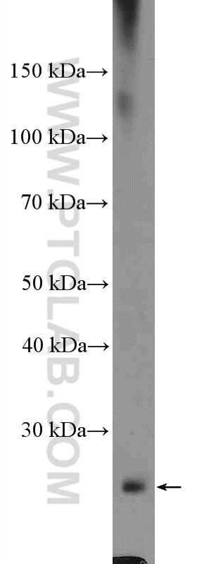 Western Blot (WB) analysis of COLO 320 cells using CYBRD1 Polyclonal antibody (26735-1-AP)