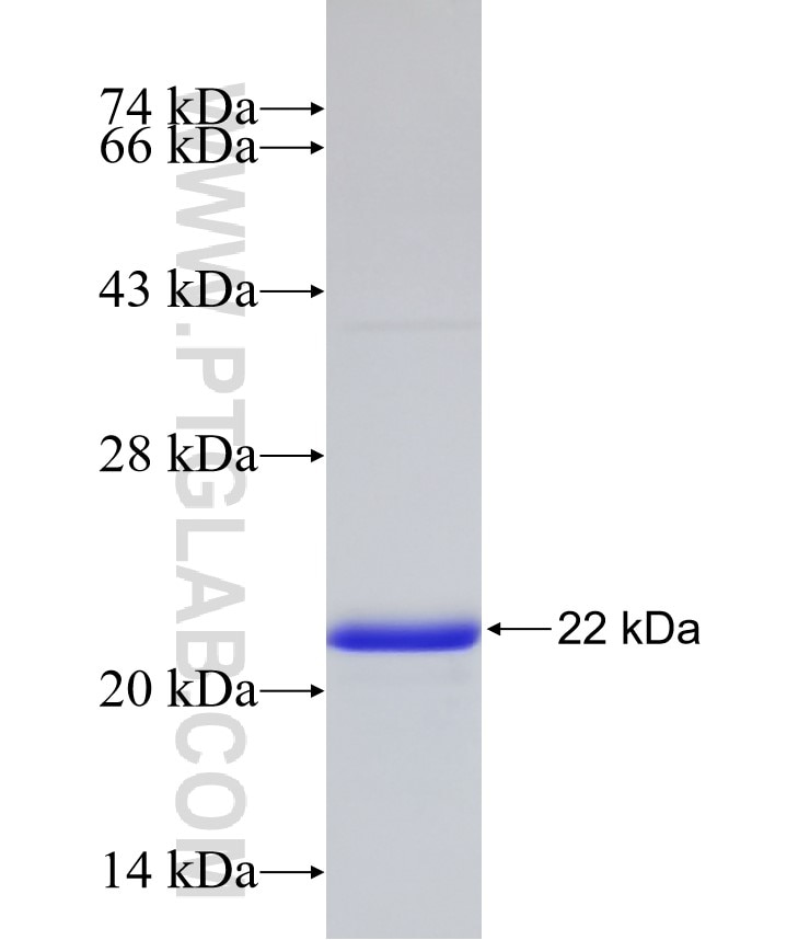 CYBRD1 fusion protein Ag24968 SDS-PAGE