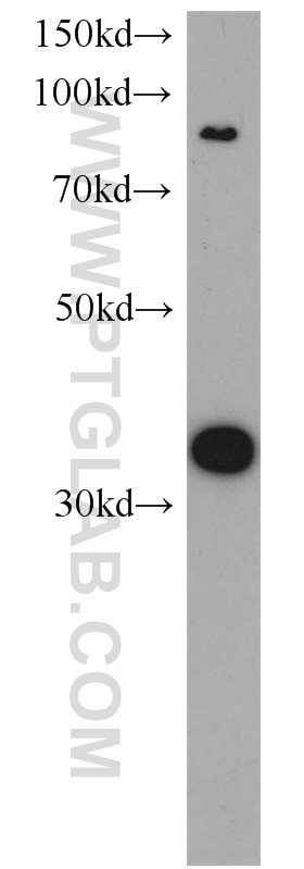 Western Blot (WB) analysis of human brain tissue using CYC1 Polyclonal antibody (10242-1-AP)