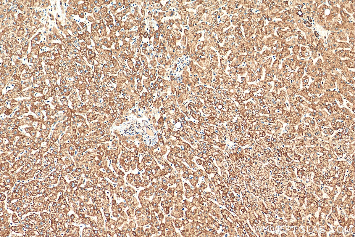 Immunohistochemistry (IHC) staining of human liver tissue using Cytochrome c Polyclonal antibody (10993-1-AP)
