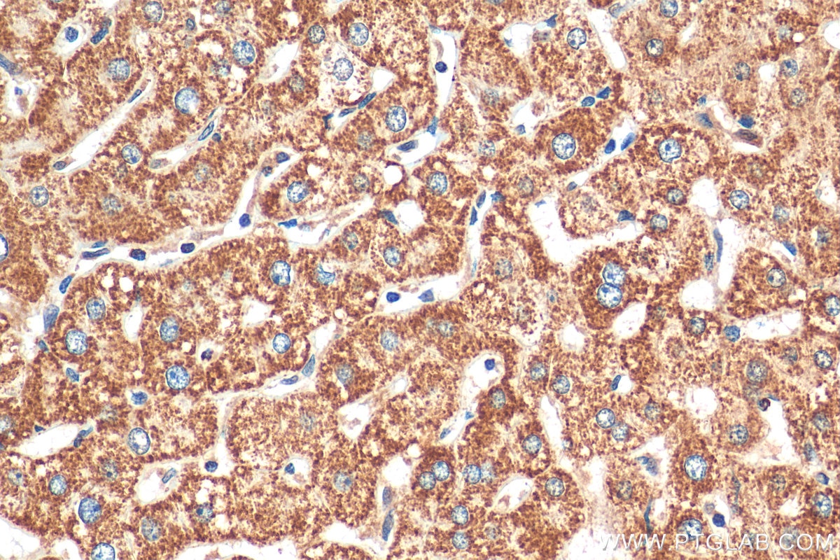 Immunohistochemistry (IHC) staining of human liver tissue using Cytochrome c Polyclonal antibody (10993-1-AP)