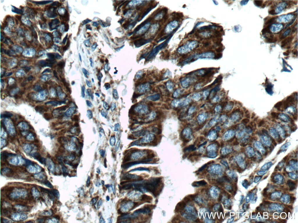 Cytochrome c Polyclonal antibody