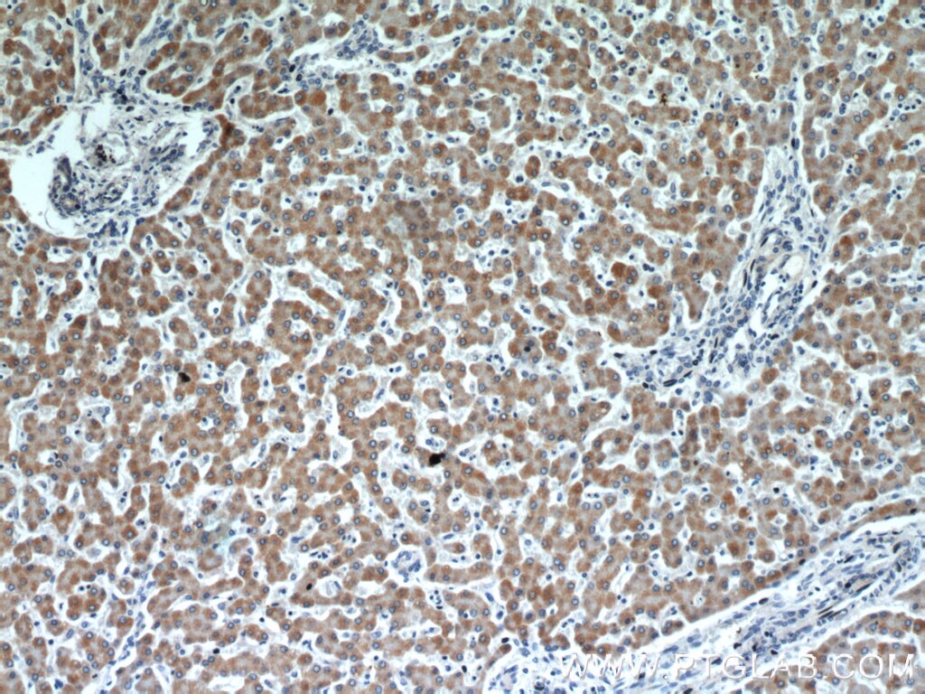 IHC staining of human liver using 10993-1-AP