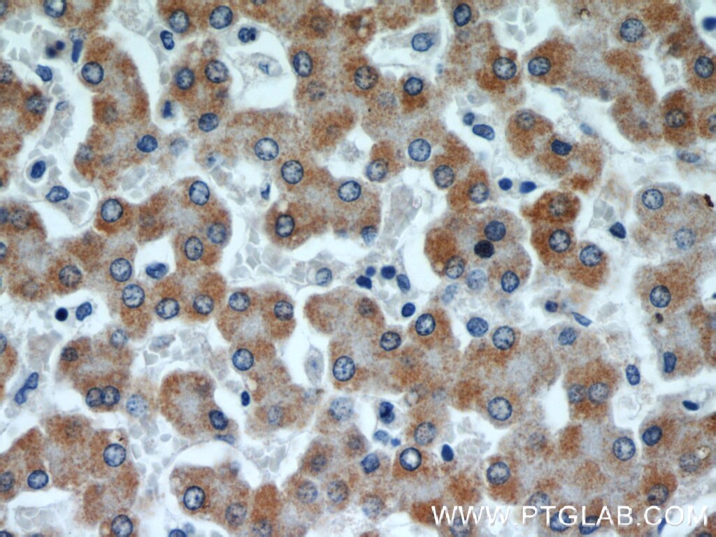 IHC staining of human liver using 10993-1-AP