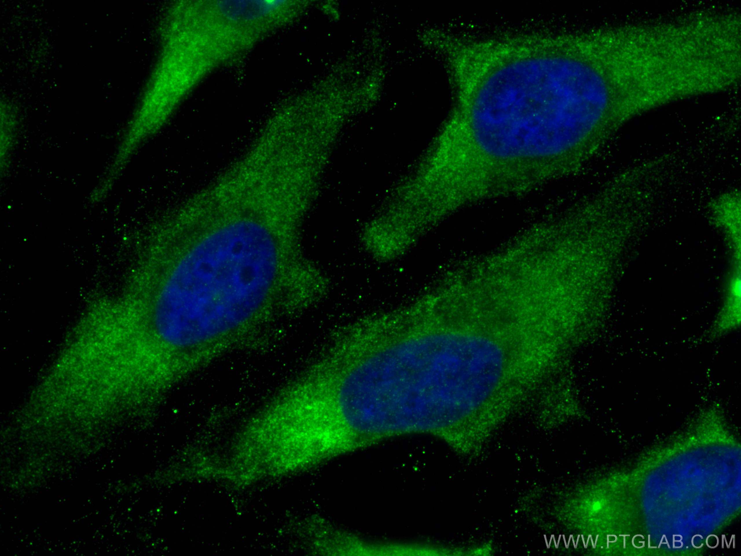 Immunofluorescence (IF) / fluorescent staining of HeLa cells using CYFIP1 Polyclonal antibody (27925-1-AP)