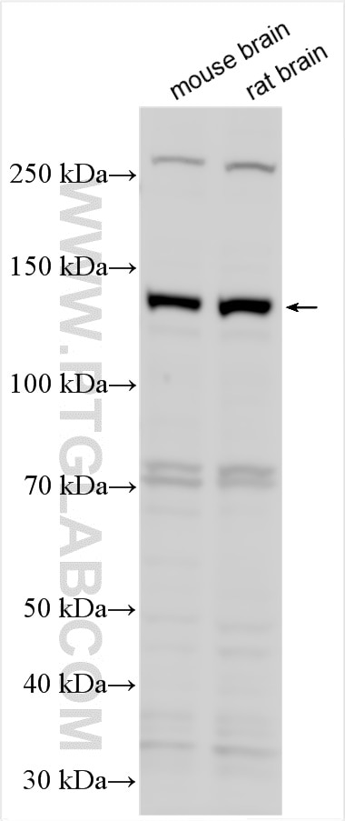 Western Blot (WB) analysis of various lysates using CYFIP1 Polyclonal antibody (27925-1-AP)