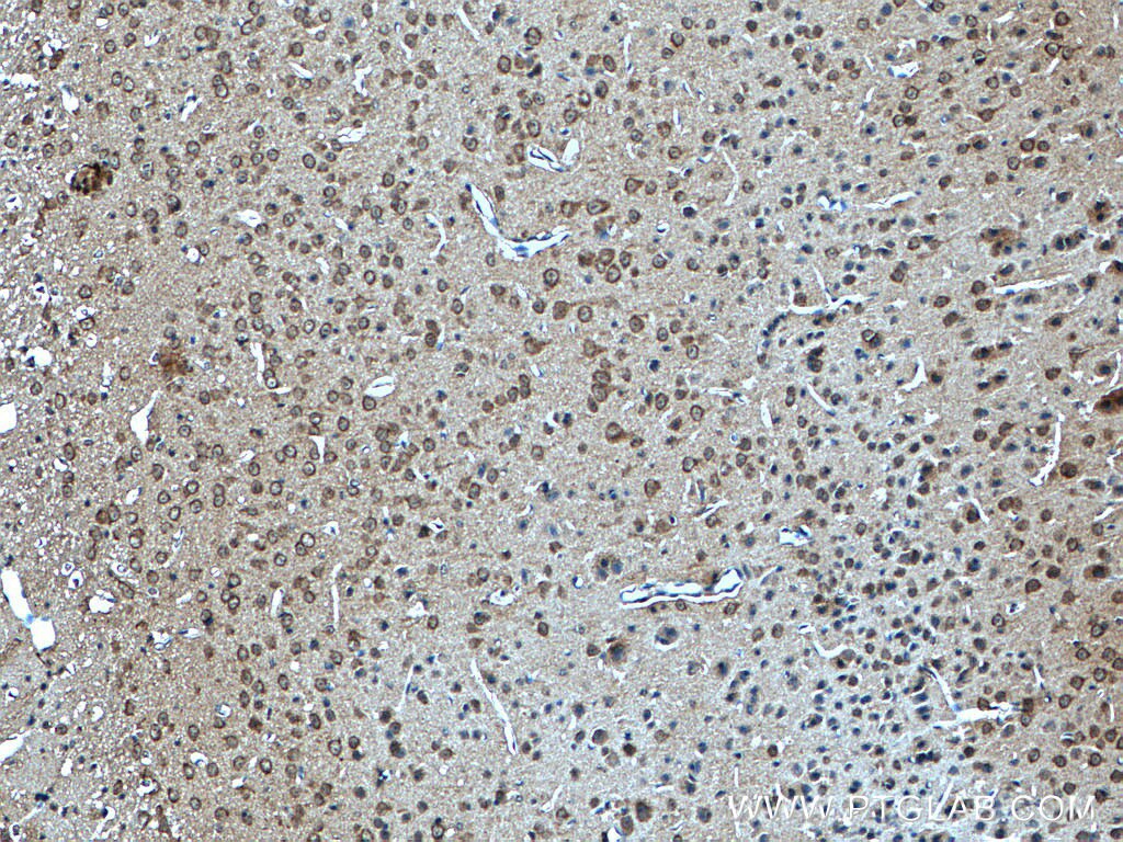 Immunohistochemistry (IHC) staining of mouse brain tissue using CYFIP1/2 Polyclonal antibody (16011-1-AP)