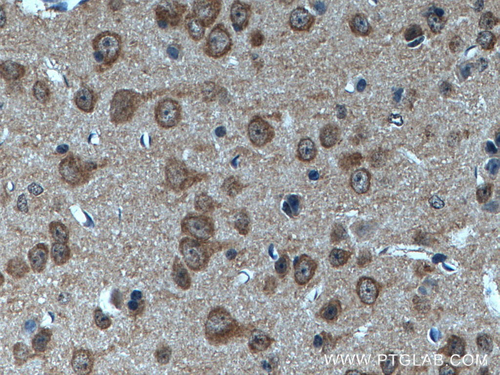Immunohistochemistry (IHC) staining of mouse brain tissue using CYFIP1/2 Polyclonal antibody (16011-1-AP)