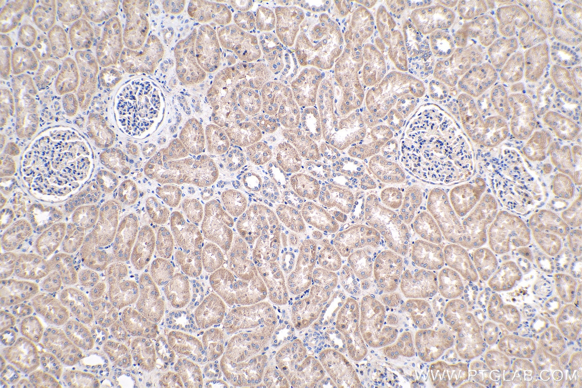 Immunohistochemistry (IHC) staining of human kidney tissue using CYFIP1/2 Polyclonal antibody (16011-1-AP)