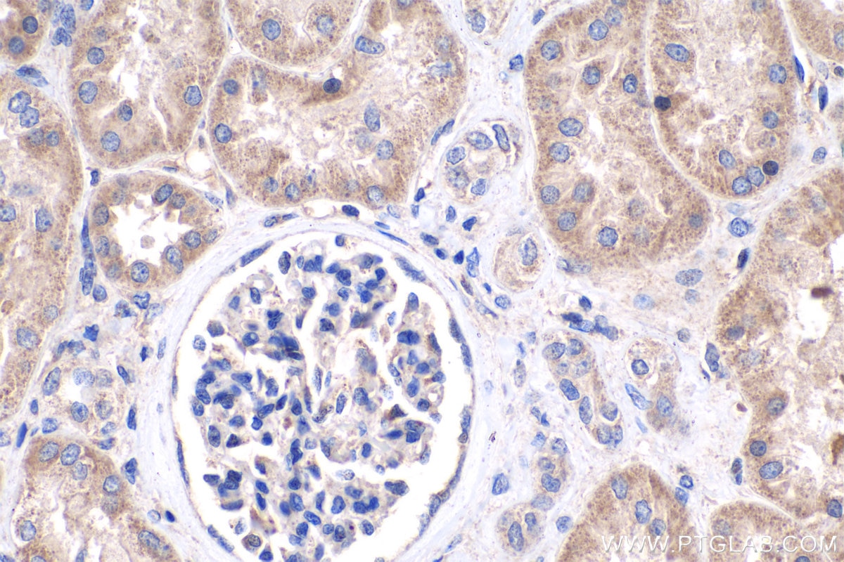Immunohistochemistry (IHC) staining of human kidney tissue using CYFIP1/2 Polyclonal antibody (16011-1-AP)