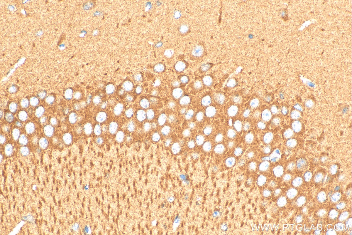 Immunohistochemistry (IHC) staining of mouse brain tissue using CYFIP1/2 Polyclonal antibody (16011-1-AP)