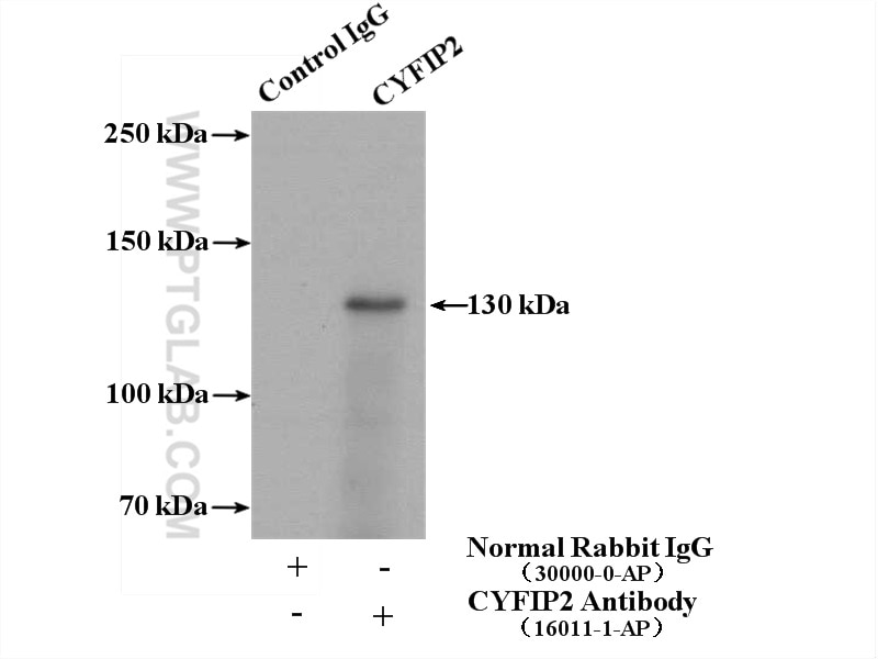 Immunoprecipitation (IP) experiment of mouse brain tissue using CYFIP1/2 Polyclonal antibody (16011-1-AP)