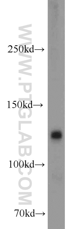 Western Blot (WB) analysis of human brain tissue using CYFIP1/2 Polyclonal antibody (16011-1-AP)