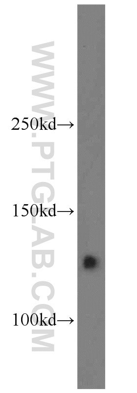 Western Blot (WB) analysis of mouse brain tissue using CYFIP1/2 Polyclonal antibody (16011-1-AP)