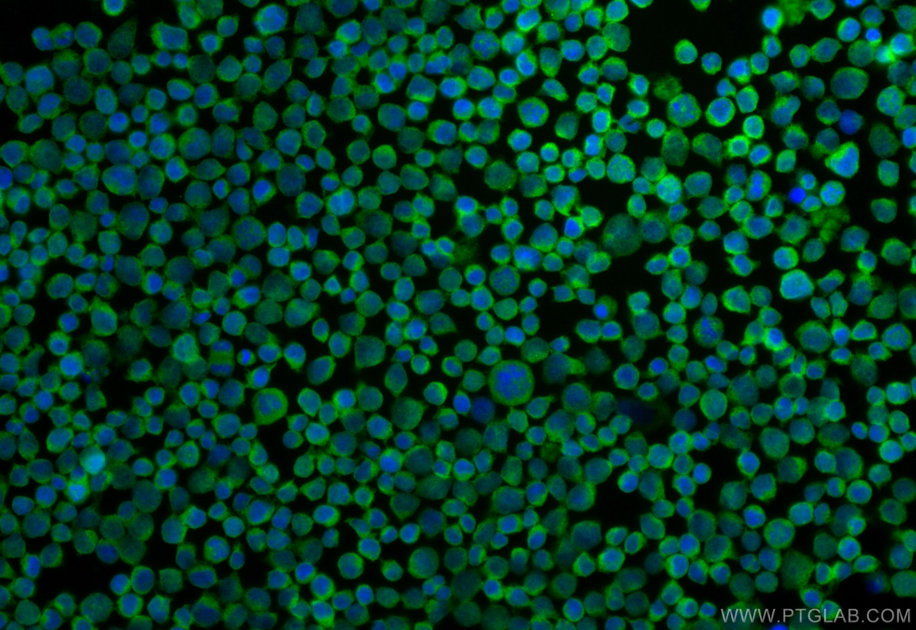 Immunofluorescence (IF) / fluorescent staining of Jurkat cells using CoraLite® Plus 488-conjugated CYFIP2 Recombinant a (CL488-83845-3)