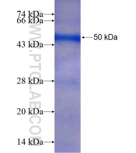 CYFIP2 fusion protein Ag8749 SDS-PAGE