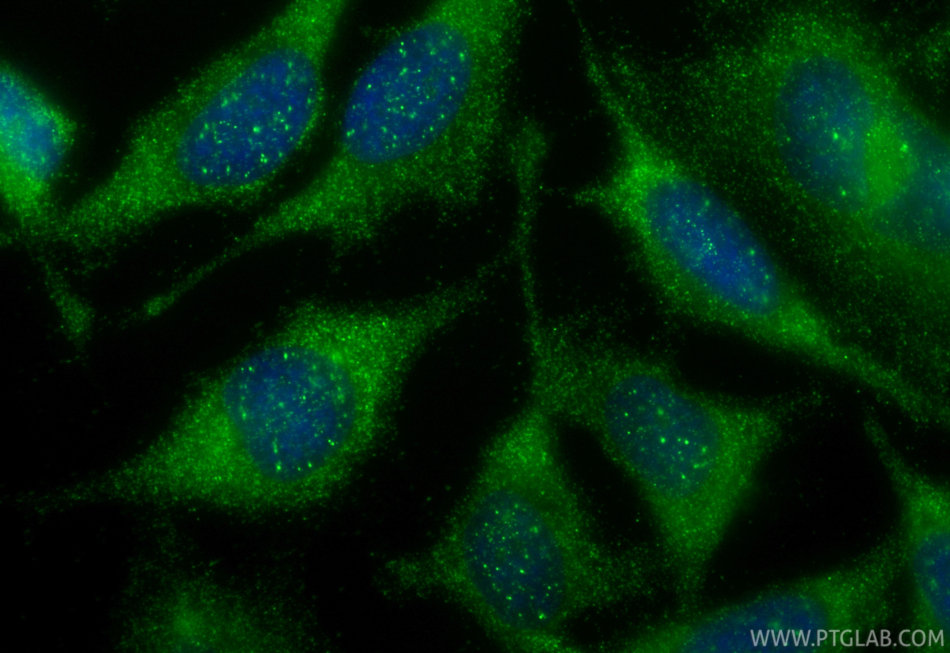 Immunofluorescence (IF) / fluorescent staining of HeLa cells using Cytoglobin Polyclonal antibody (13317-1-AP)